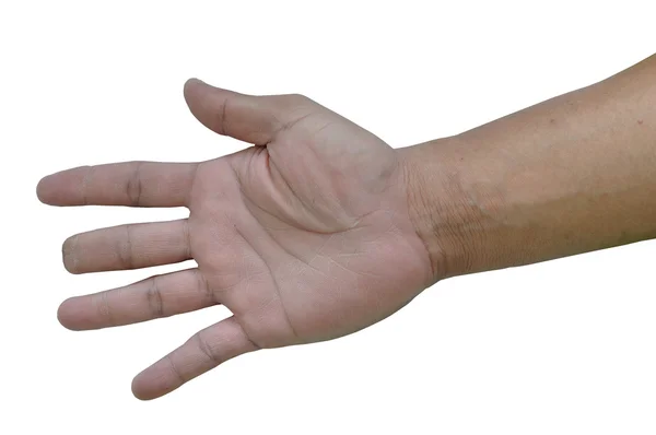 Injured hand — Stock Photo, Image