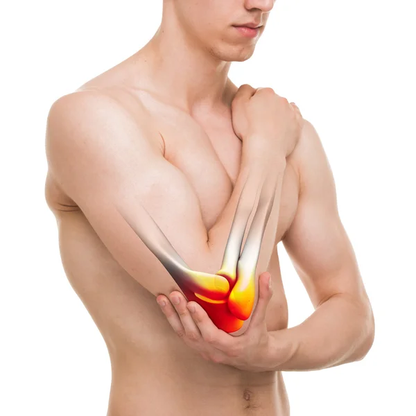 Dolor de codo en brazo lesionado aislado en blanco - Anatomía Hombre —  Fotos de Stock