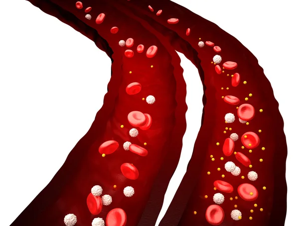Kan akışı - normal vs diyabet - beyaz izole — Stok fotoğraf