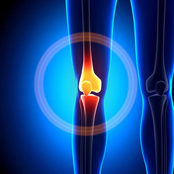 Female Knee Joint - Anatomy Bones — Stock Photo, Image