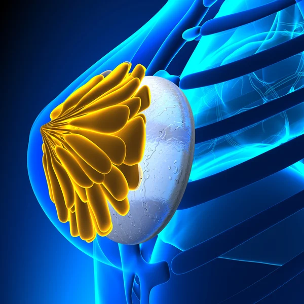 Имплантат женской груди — стоковое фото