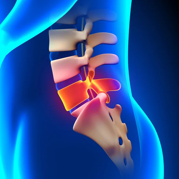 L5 Disc - Lumbar Spine — Stock Photo, Image