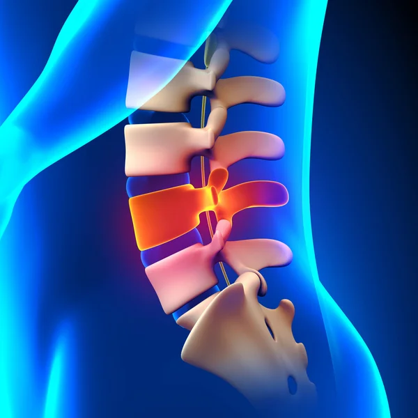 L4 Disc - Lumbar Spine — Stock Photo, Image