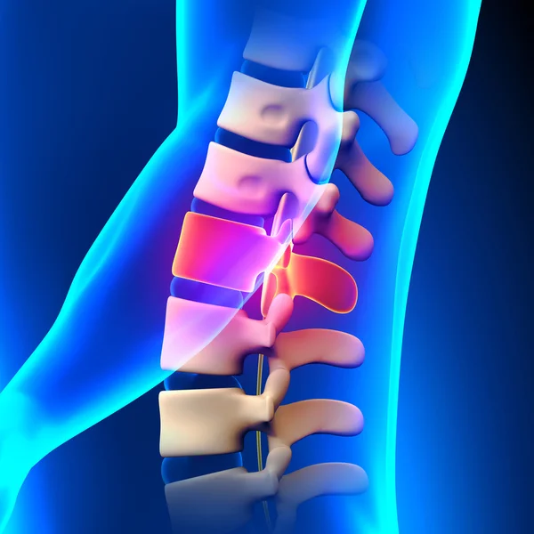 L1 Disc - Lumbar Spine — Stock Photo, Image