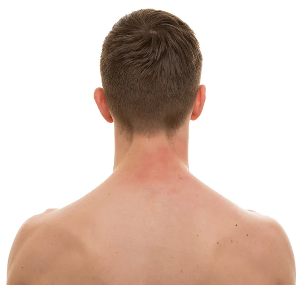 Cuello masculino Espalda aislada en blanco - Anatomía REAL — Foto de Stock