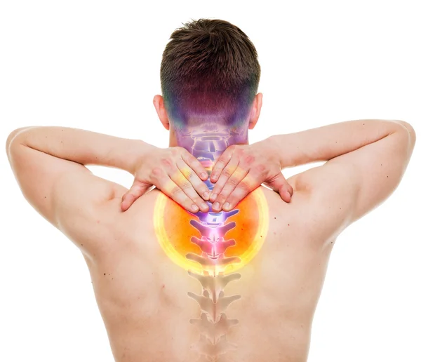 Nackenschmerzen - männlich verletzte Halswirbelsäule isoliert auf weiß - echt ein — Stockfoto
