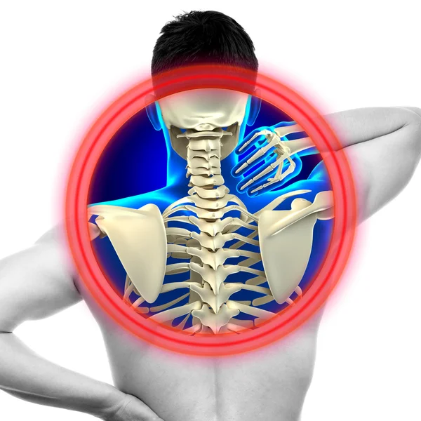 Dolor en el cuello Columna cervical aislada en blanco - REAL Anatomía cóncava — Foto de Stock