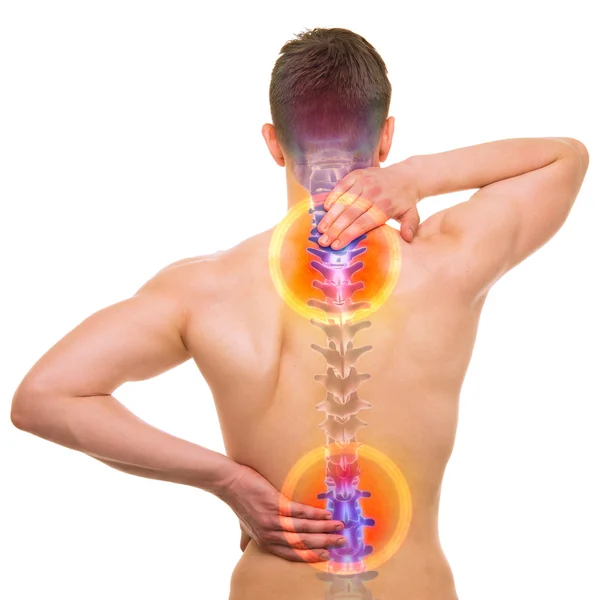 Rug pijn - mannelijke pijn Backbone geïsoleerd op wit - echte anatomie — Stockfoto