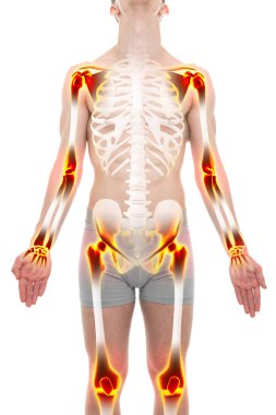 Arthritis Joints Pain Anatomy Male concept clipart