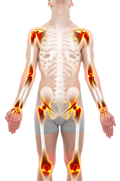 Arthritis Gelenke Schmerzen Anatomie männliches Konzept — Stockfoto