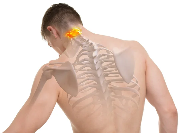 Atlas C1, C2 omurga anatomisi üzerine beyaz izole — Stok fotoğraf