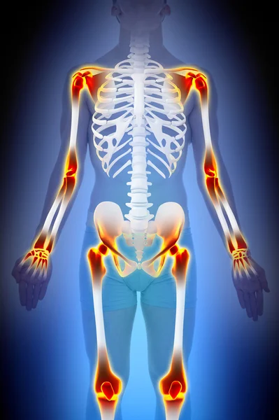 Артрит суставов анатомия мужской концепции — стоковое фото