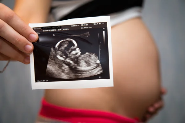 Estómago embarazada — Foto de Stock