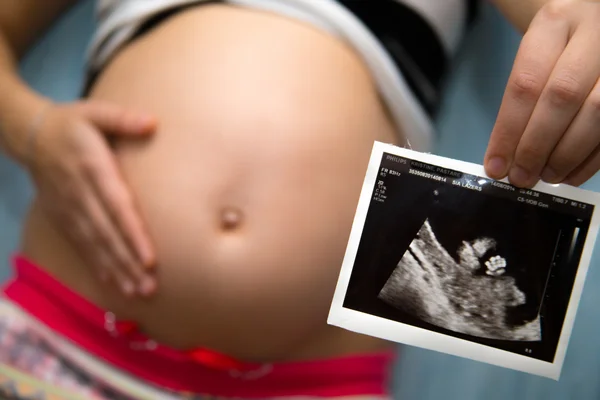妊婦の胃 — ストック写真