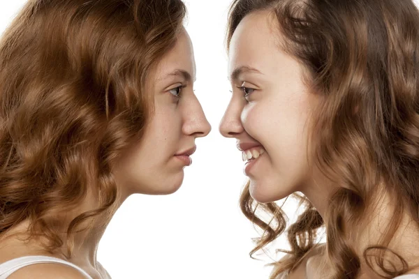 Before and after rhinoplasty — Stock Photo, Image