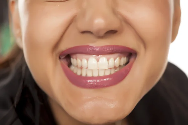 Beautiful white teeth — Stock Photo, Image