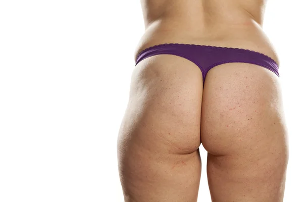 Obese female buttocks — Stock Photo, Image