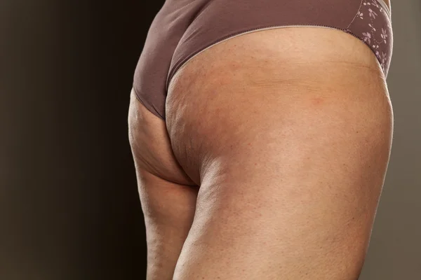 Obesi glutei femminili — Foto Stock