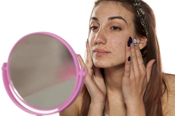 Skincare - problematic skin — Stock Photo, Image