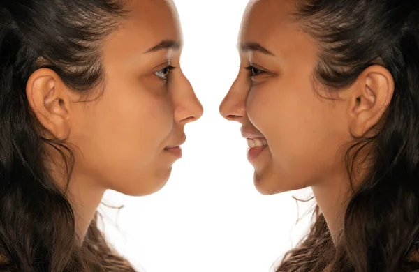 comparison portrait of young latin woman before and after nose job on white background