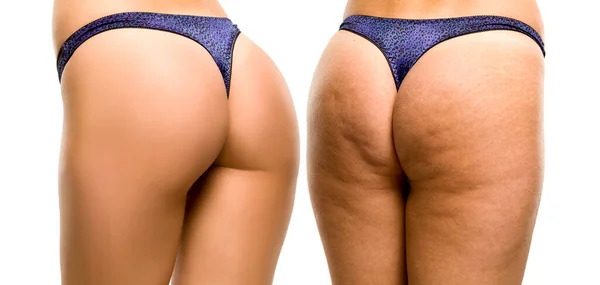 Female Buttocks White Background — Stock Photo, Image