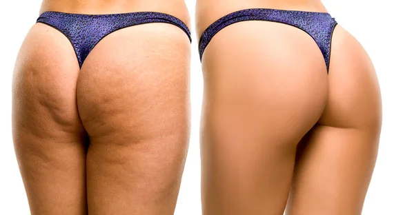 Female Buttocks White Background — Stock Photo, Image