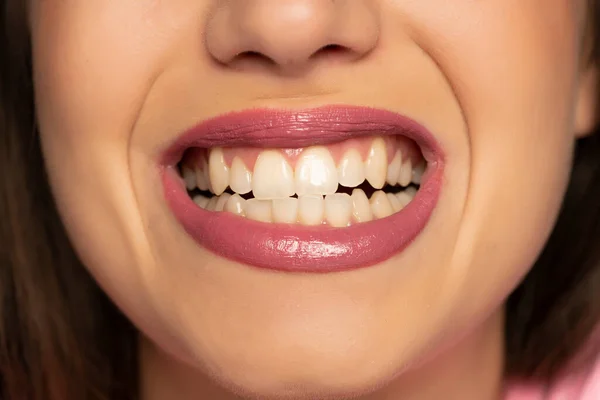 Jovem Mulher Mostrando Seus Dentes Saudáveis — Fotografia de Stock