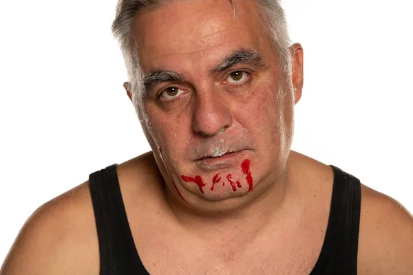 Infeliz Hombre Mediana Edad Con Sangre Cara Sobre Fondo Blanco — Foto de Stock