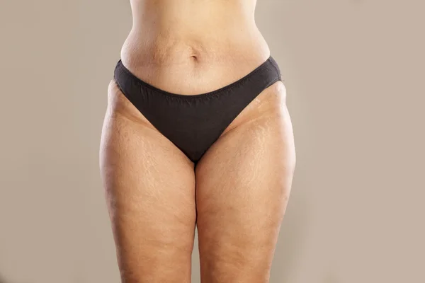 Mujer obesa — Foto de Stock