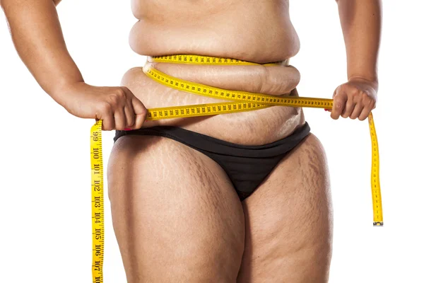 Obese woman — Stock Photo, Image