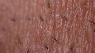 Ekstrem makro insan derisi dokusunun HD videosu. Tarafsız bir arka planda tıraş edilmiş saç uzaması ve sakalları var.