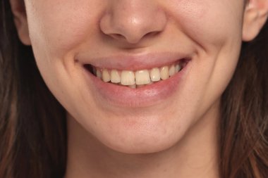 Bir kadının gülümseyen dudaklarını ve dişlerini yakın plan beyaz arka planda makyajsız ve temiz ciltli..