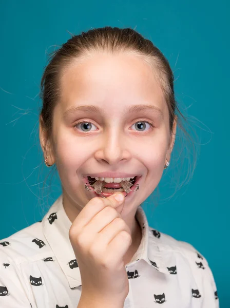 Menina feliz segurando aparelhos dentários — Fotografia de Stock