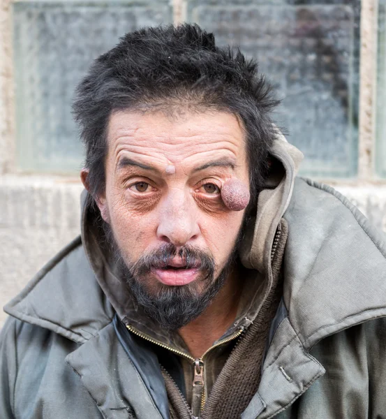 Un senzatetto per strada — Foto Stock
