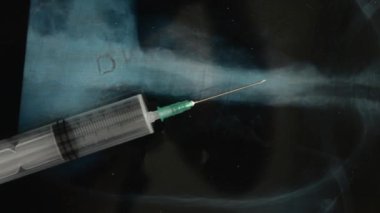 Coronavirus aşısı için yapılan şırınganın röntgen çekiminin arka planında incelenmesi