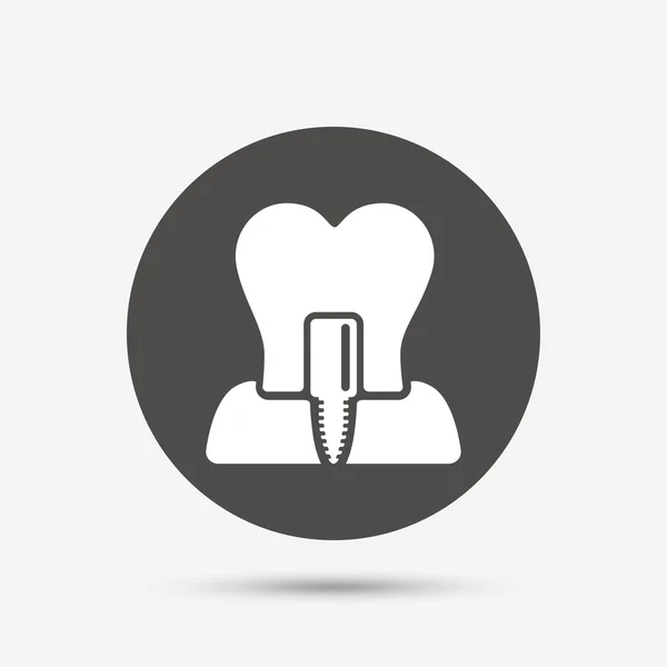 Zeichen für Zahnimplantate — Stockvektor