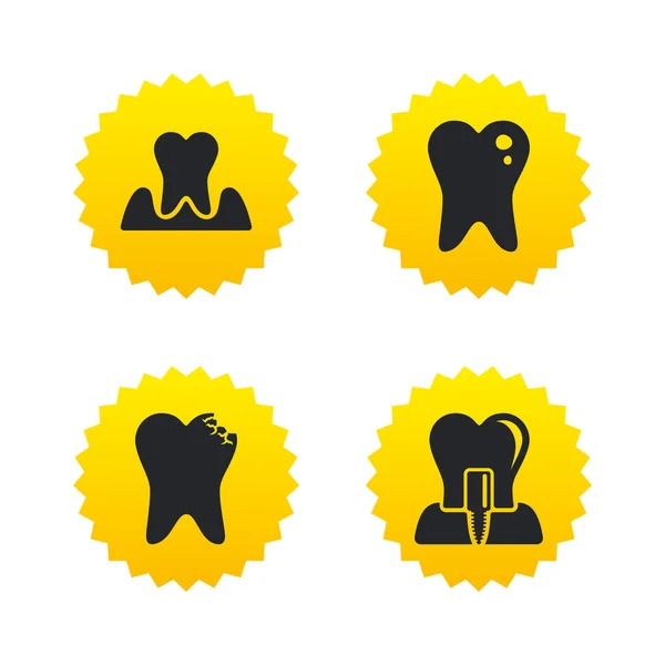 Iconos de cuidado dental. Caries dental e implante . — Vector de stock
