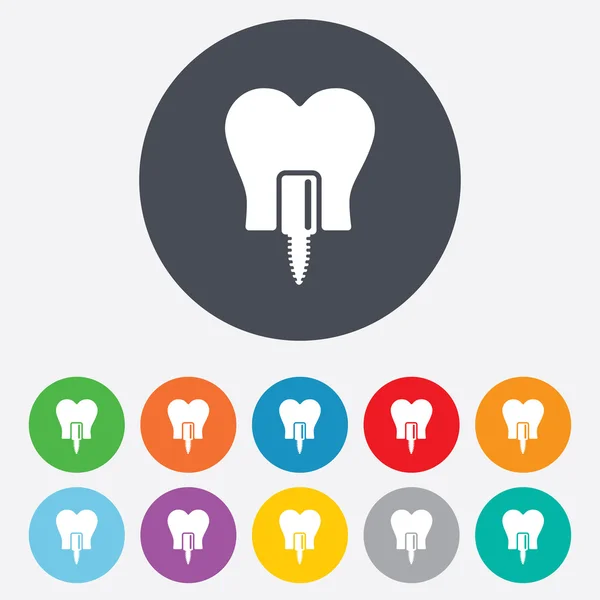 Tooth implant signs — Stock Vector