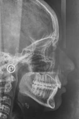 Maxilofacial x-ışını bir diş hekimi tedavi için. Ortodonti diagnos