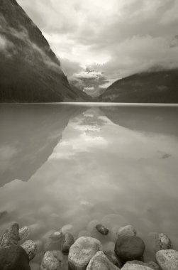 Lake Louise Kanada manzara. Alberta. Kanada