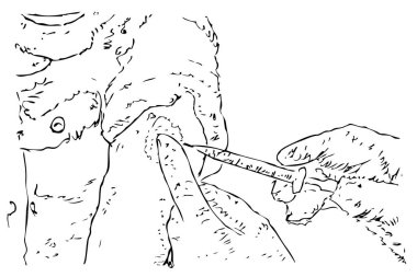 Vektör Elle Çizim, El Sryinge 'den Boşal