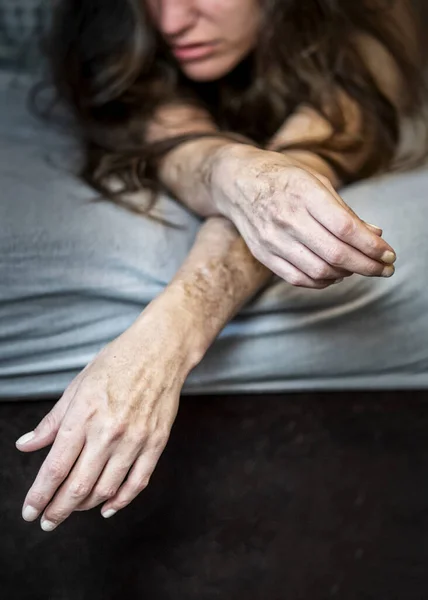 Hüsrana uğramış, hayal kırıklığına uğramış, yatakta yatan, kendini yaralayan, hayal kırıklığına uğramış, kendine zarar veren, sınırda kişilik bozukluğu olan, kendini yaralayan hasta bir kadın.