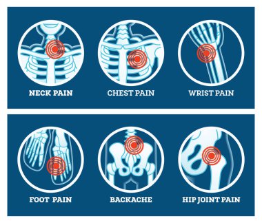 Body Pain. Icons Set. Pain in Neck, Chest, Foot, Backache, Hip Joint and Wrist. Woman's and Man's Body Parts. clipart