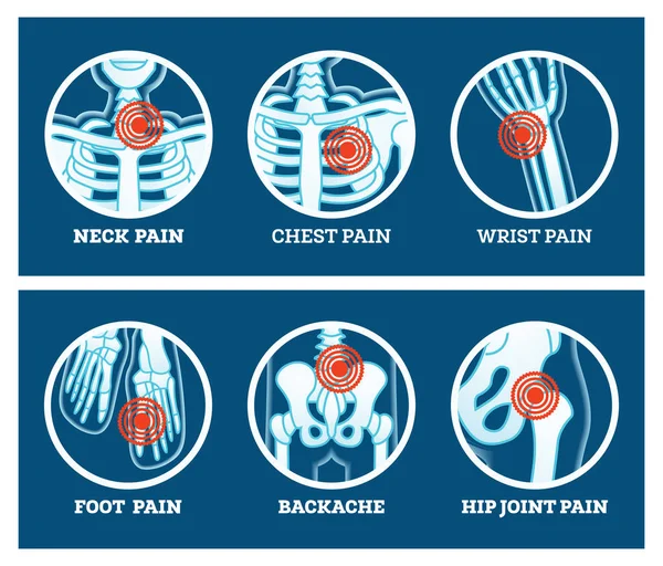 Body Pain. Icons Set. Pain in Neck, Chest, Foot, Backache, Hip Joint and Wrist. Woman's and Man's Body Parts.