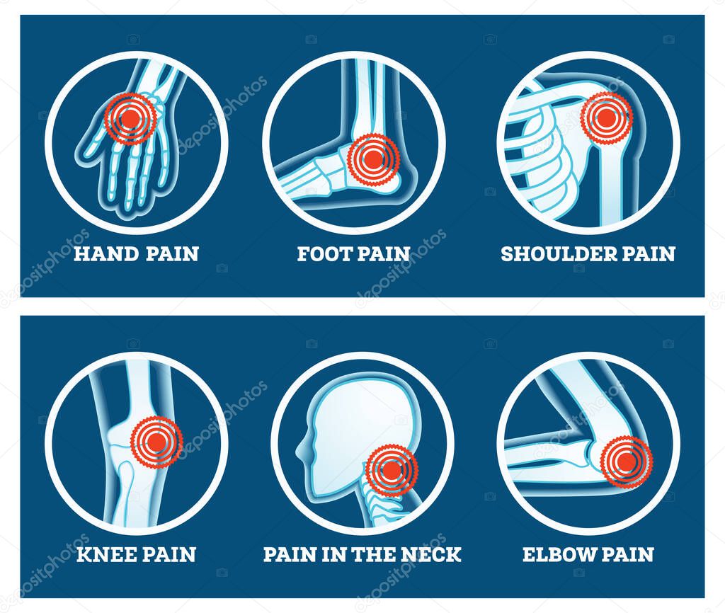 Body Pain. Icons Set. Pain in Hand, Knee, Neck, Elbow, Foot and Shoulder. Woman's and Man's Body Parts.