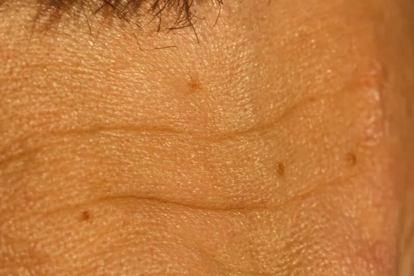 Photo of a male forehead with deep wrinkles and pores. Dermatology, Botex injections. In soft focus with high magnification