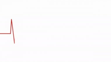 Kalp atış hızı monitörü, animasyon kardiyogramı. Kalp kardiyogramının kırmızı ölçekli videosu, düzenli bir ritm gösteriyor. EKG izleme..