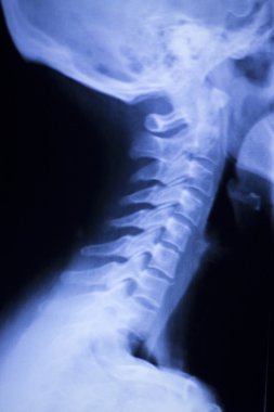Kafatası boyun omurga omuz xray inceden inceye gözden geçirmek