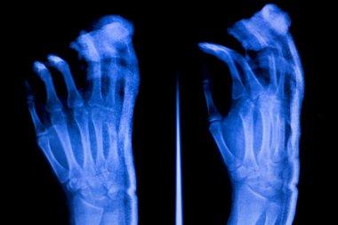 El parmakları başparmak bilek xray inceden inceye gözden geçirmek