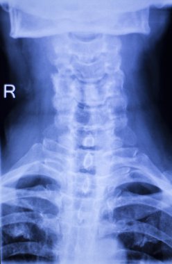 Kafatası boyun omurga omuz xray inceden inceye gözden geçirmek